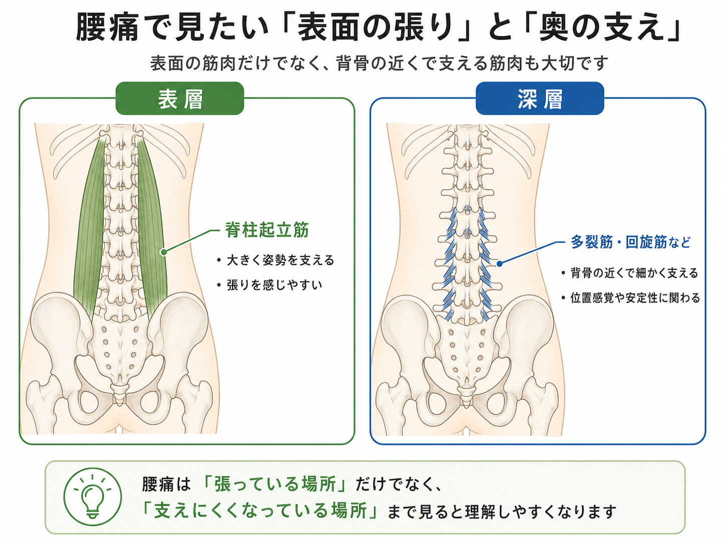 腰痛で見たい脊柱起立筋と多裂筋・回旋筋など深層筋の違いを示した解説図